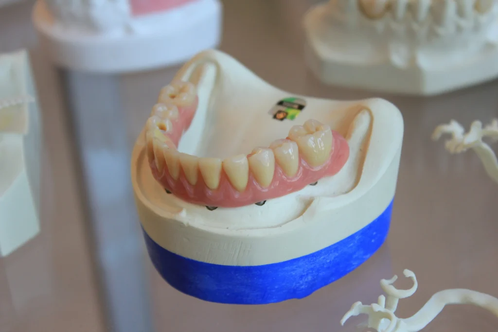 Alternatives to Denture Glue