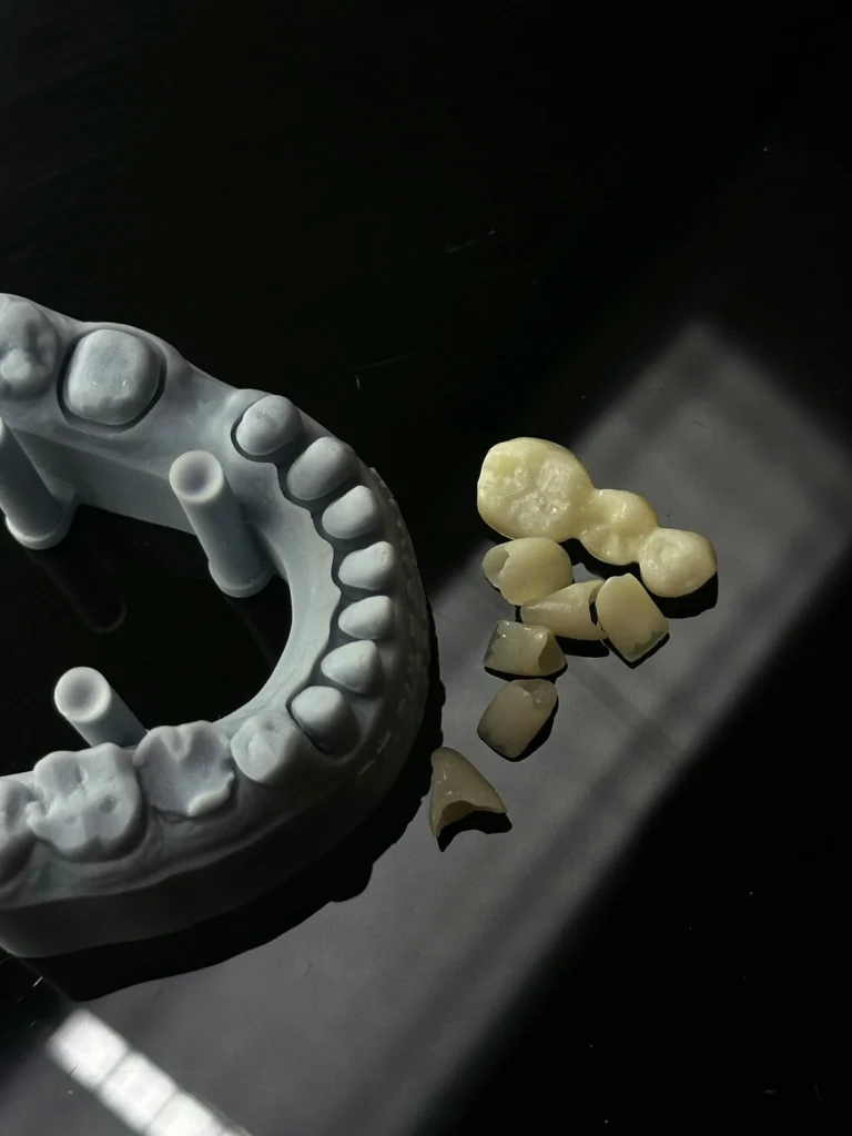Best Practices for Denture Glue Use