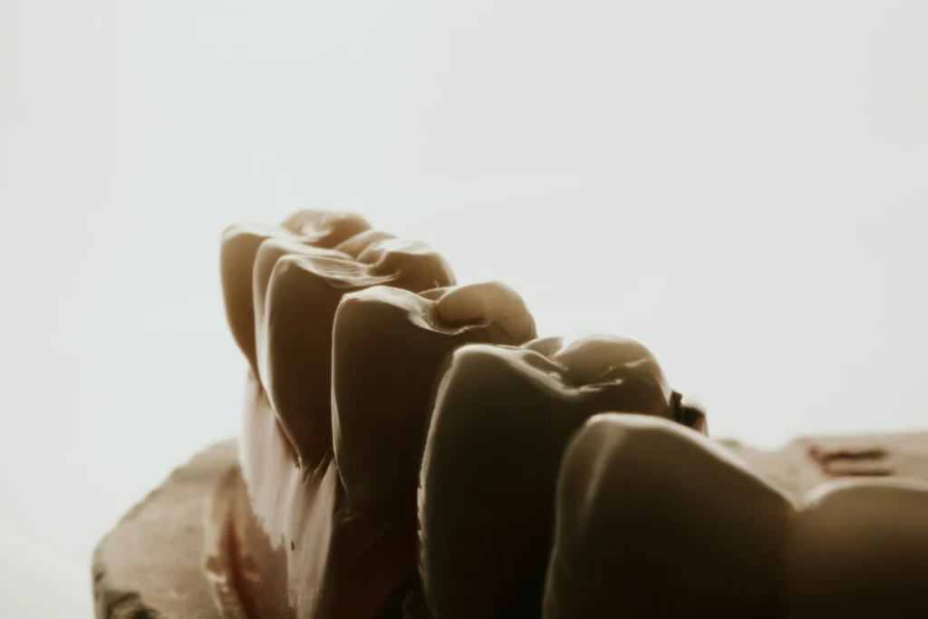 Teeth Grinding and Dementia Special Considerations for Dentures