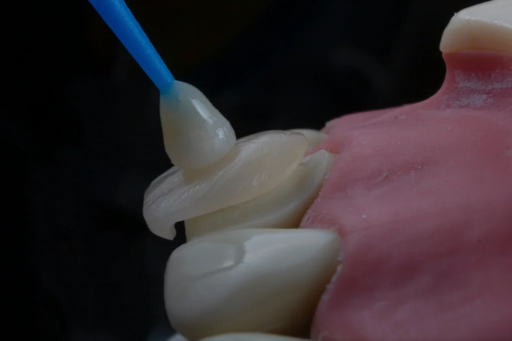 Why Choose Dental Home Services