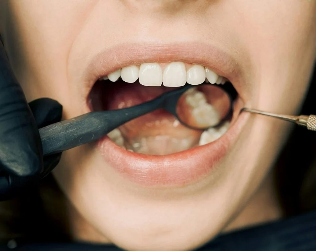 The Health Risks of Skipping Oral Care