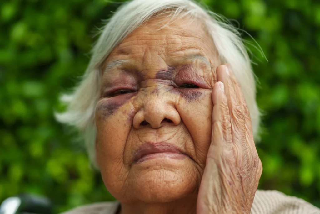 How to Know When to Intervene with Tooth Picking