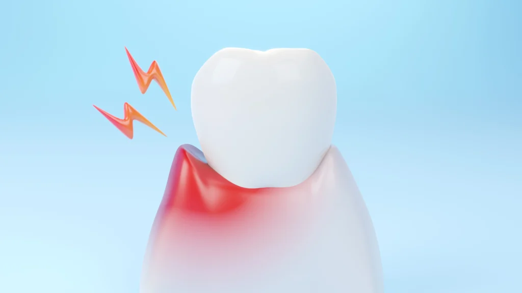 Swelling of Gums in Between Teeth and Gum Disease What the Data Suggests
