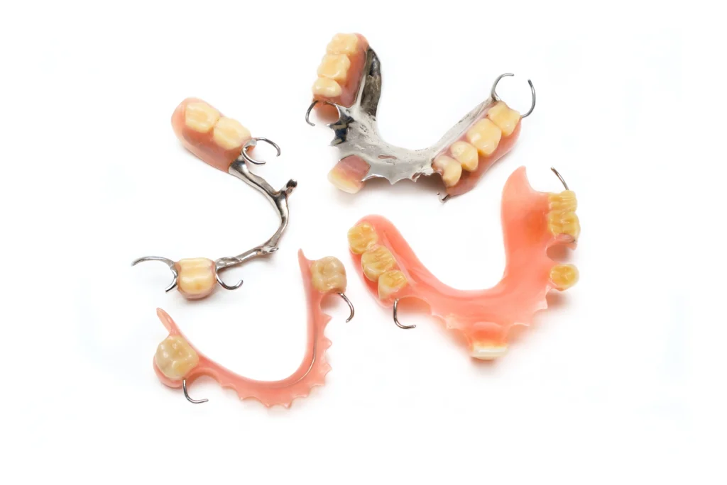 ypes of Partial Dentures Options Dental Home Services Sees Most