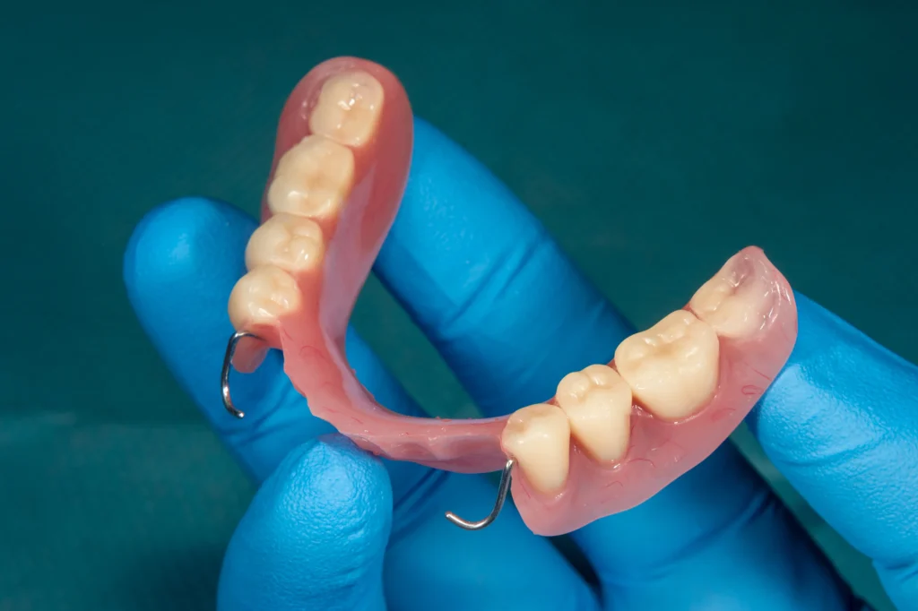 Types of Partial Dentures and Who They Fit Best