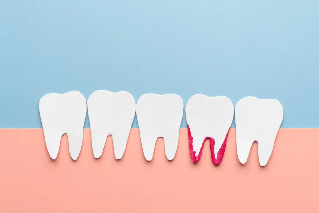 How to Stop Gums From Bleeding Fast Without “Over-Cleaning”