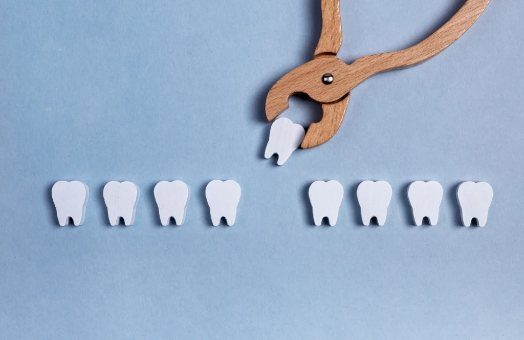 Emergency Tooth Extraction at Home What Mobile Dentists Do