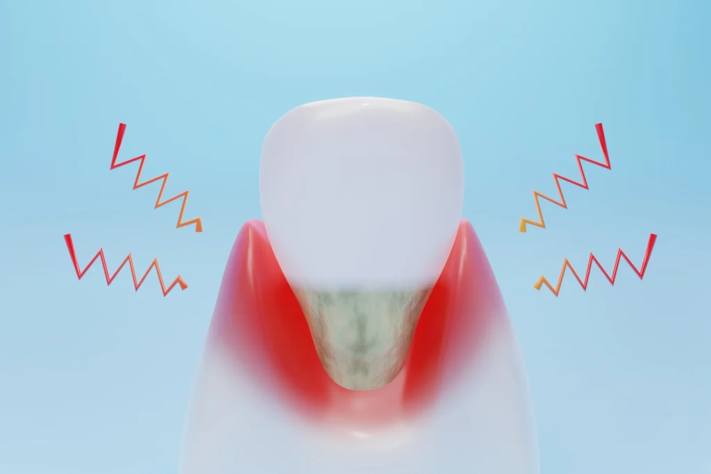 How to Stop Infected Tooth Pain Fast and When to Escalate